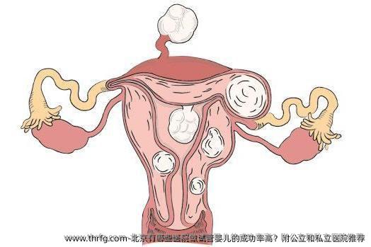 北京有哪些医院做试管婴儿的成功率高？附公立和私立医院推荐