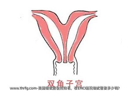 美国做试管医院排名，在ENCI医院做试管要多少钱?