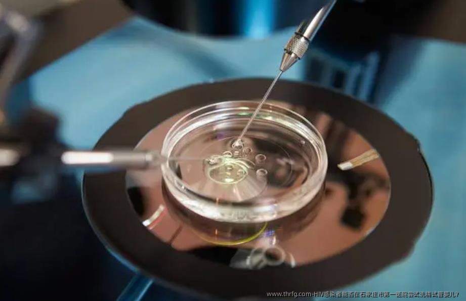 HIV感染者能否在石家庄市第一医院尝试洗精试管婴儿？