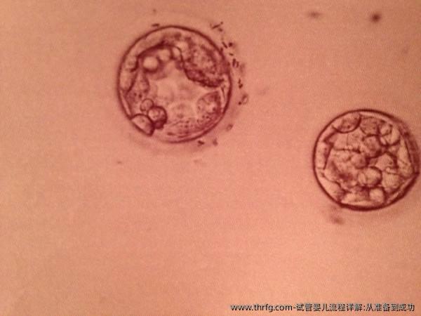 试管婴儿流程详解:从准备到成功需要多长的时间