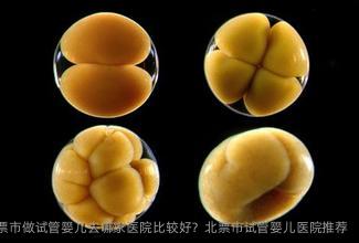 2025年在北票市做试管婴儿去哪家医院比较好？北票市试管婴儿医院推荐