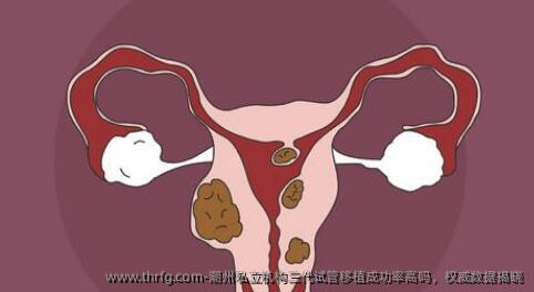 潮州私立机构三代试管移植成功率高吗，优秀数据揭晓