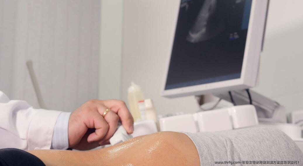 年轻女性使用微刺激方案成功率如何？