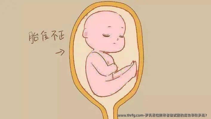 罗氏易位携带者做试管的成功率有多高？