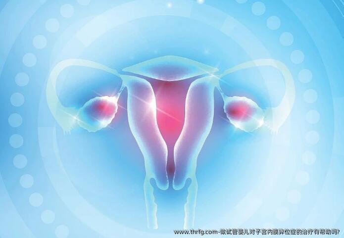 做试管婴儿对子宫内膜异位症的治疗有帮助吗?