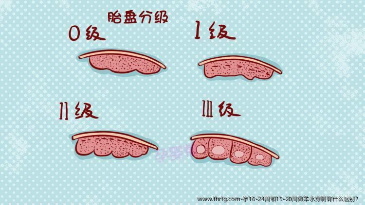 孕16-24周和15-20周做羊水穿刺有什么区别？