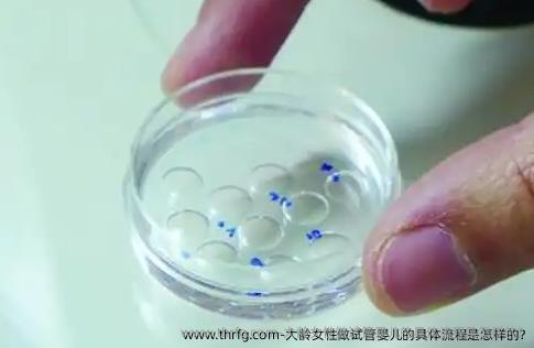 大龄女性做试管婴儿的具体流程是怎样的?