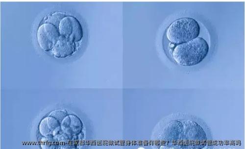 在成都华西医院做试管身体准备有哪些？华西医院做试管成功率高吗
