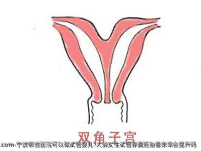 宁波哪些医院可以做试管婴儿?大龄女性试管养囊胚胎着床率会提升吗