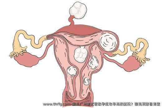 盘点广州做试管助孕成功率高的医院？擦亮双眼看清楚
