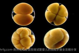 荆州去私立医院做试管婴儿的流程步骤全攻略分享