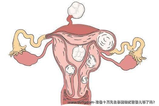 准备十万元去泰国做试管婴儿够了吗？