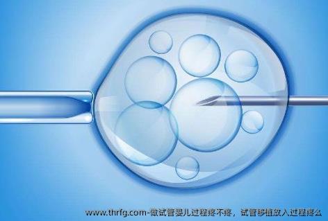做试管婴儿过程疼不疼，试管移植放入过程疼么
