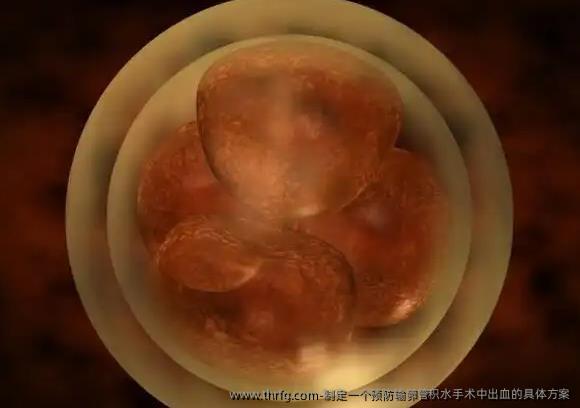 制定一个预防输卵管积水手术中出血的具体方案