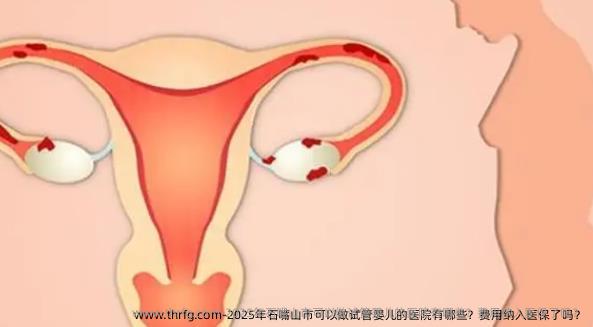 2025年石嘴山市可以做试管婴儿的医院有哪些？费用纳入医保了吗？