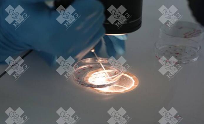 精子畸形率高可以做泰国试管吗？这是很多不育夫妇关心的问题