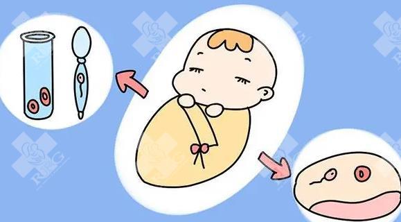 试管婴儿费用中，哪些是可以节省的？移植后多久可以恢复日常活动？
