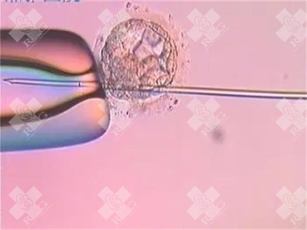 2025年在牡丹江市做试管婴儿去哪家医院比较好？