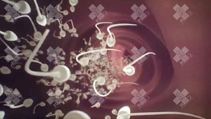 微刺激方案具体是怎么做的？有没有其他降低复发风险的方法？