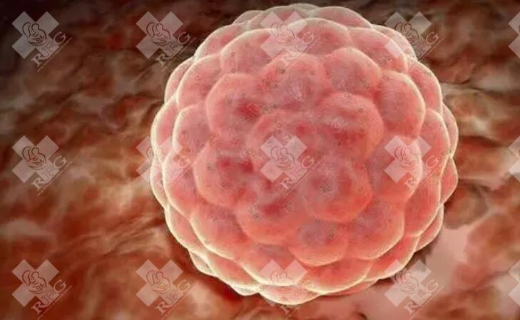 哪些情况下需要进行宫腔镜手术治疗宫腔粘连？